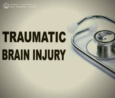 Traumatic brain in San Gabriel Valley | Workers' Compensation Law Firm in California